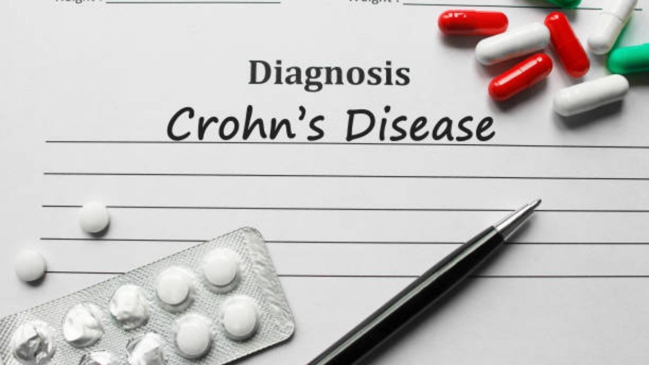 crohn's disease curable