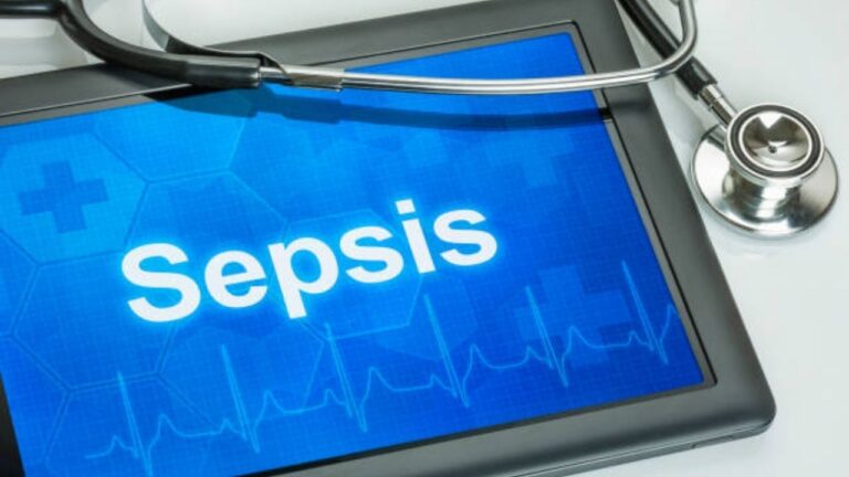 sepsis can be cured