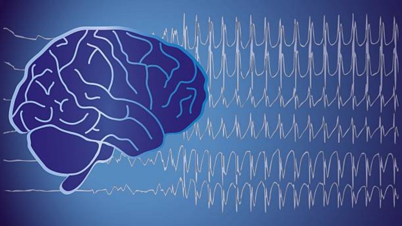 Epilepsy: Symptoms, Causes, Treatment & More