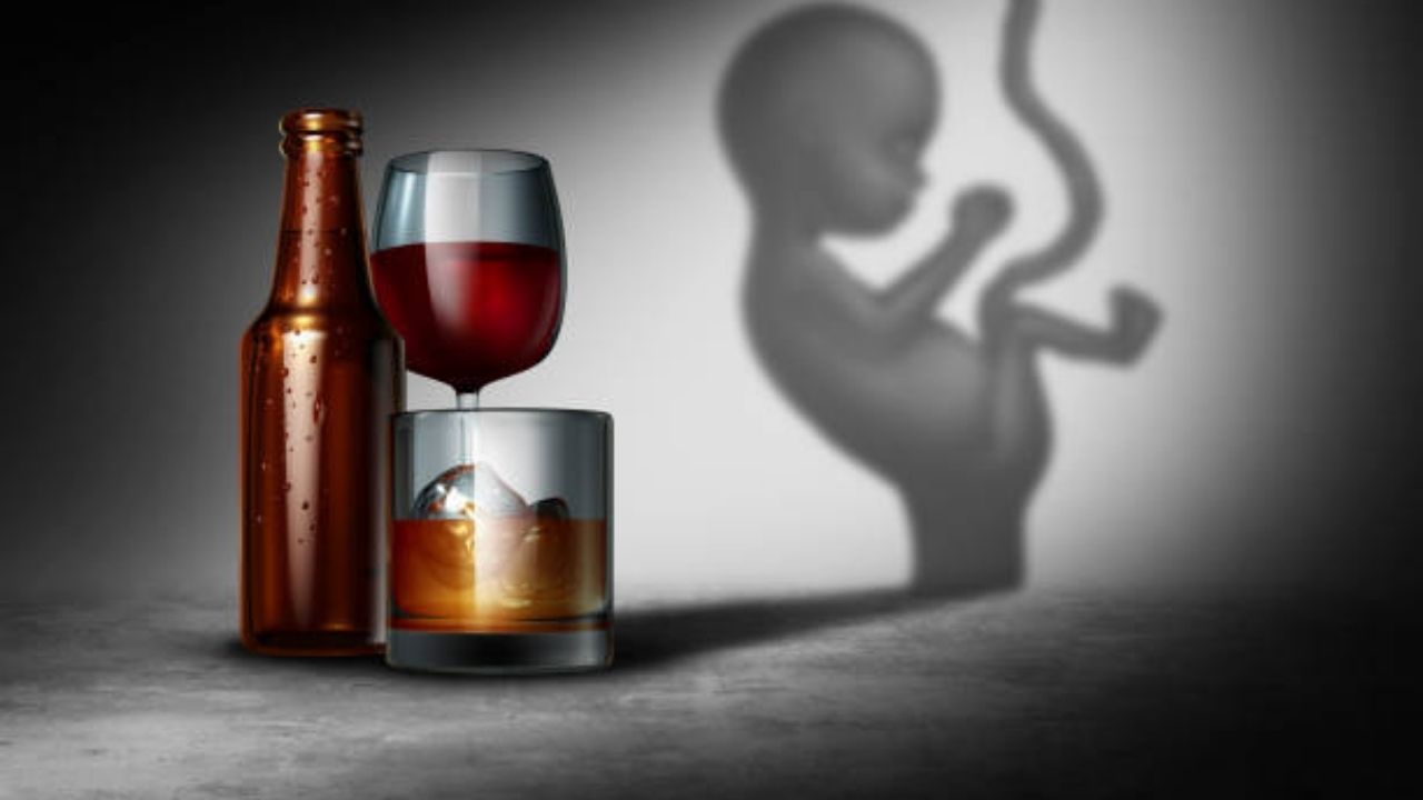 Fetal Alcohol Syndrome adult