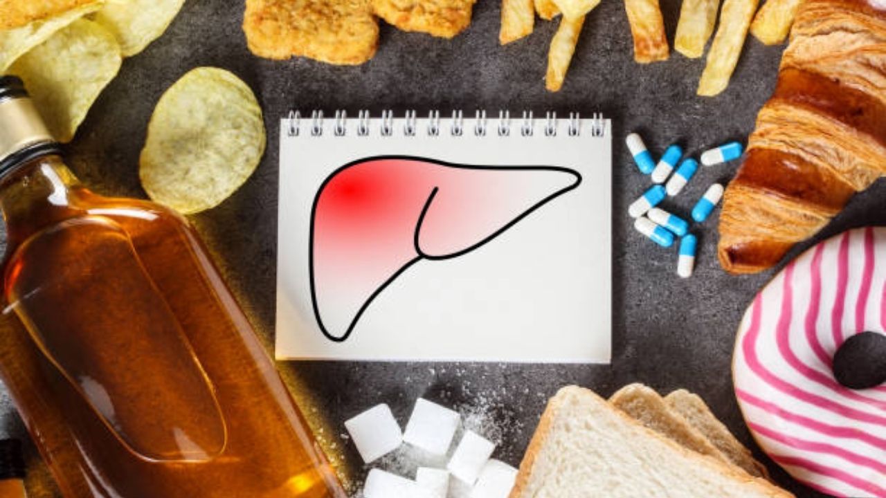 Fatty liver diet plan pdf