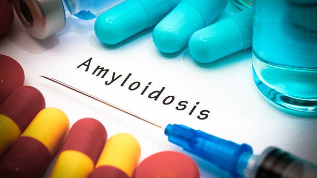 amyloidosis treatment