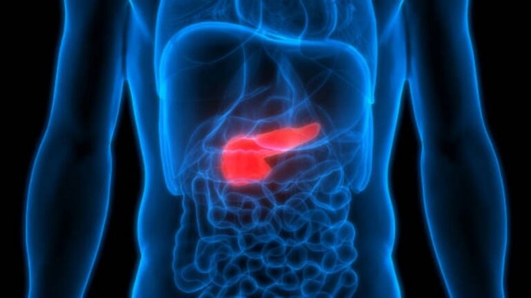 How Pancreatic Cancer Is Diagnosed
