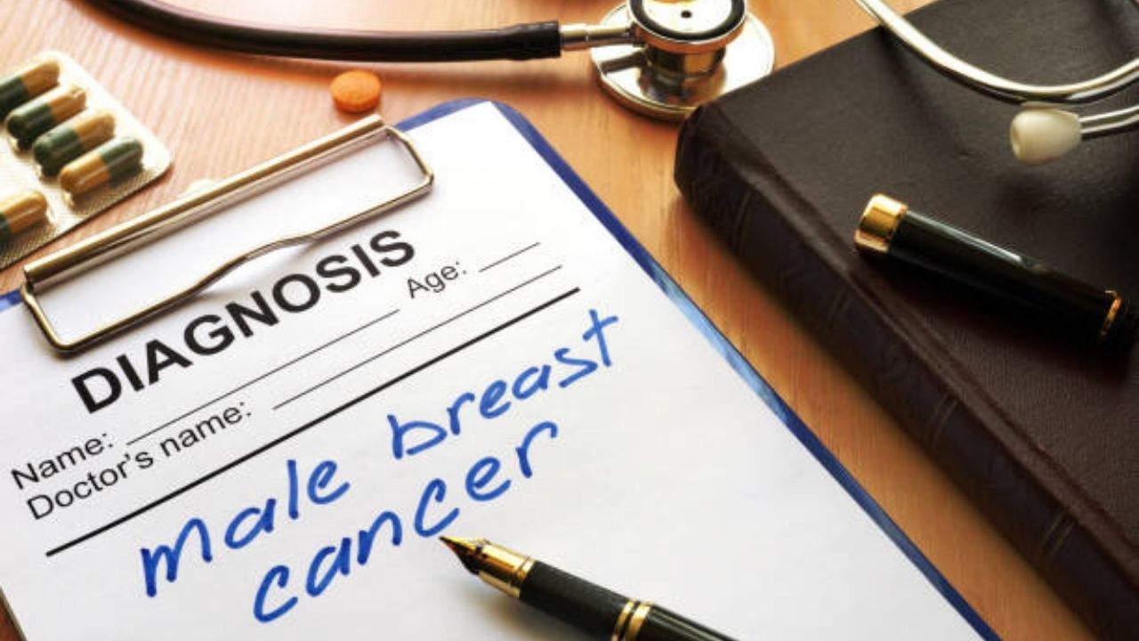 Breast Cancer In Male