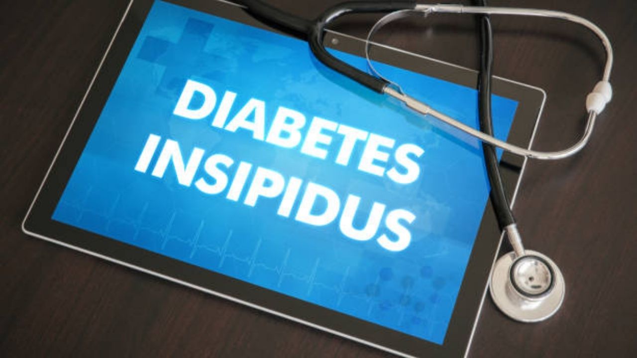 treatment for diabetes insipidus