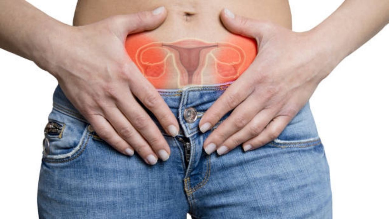 Cyst On The Ovary (Ovarian Cyst)