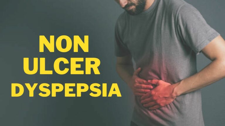 Non Ulcer Dyspepsia (Functional Dyspepsia)
